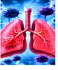 Respiratory Infections